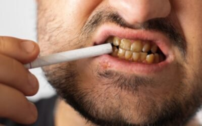 Comprehensive Exploration: Understanding the Impact of Smoking on Dental Hygiene Effects and Solutions