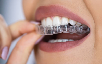 Exploring Cutting-Edge Innovations in Orthodontics Beyond Traditional Braces: A Comprehensive Guide