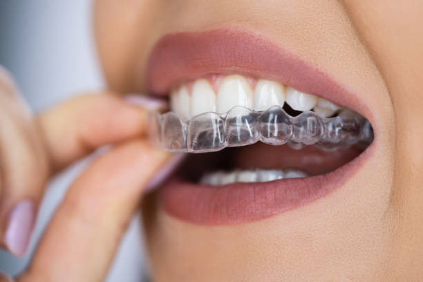 Exploring Cutting-Edge Innovations in Orthodontics Beyond Traditional Braces: A Comprehensive Guide